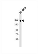 ErbB2 (HER-2) Antibody in Western Blot (WB)