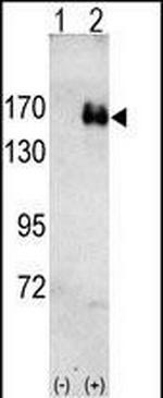 ErbB2 (HER-2) Antibody in Western Blot (WB)