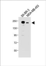 ErbB2 (HER-2) Antibody in Western Blot (WB)