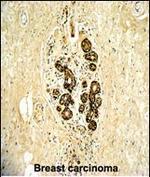 ErbB3 Antibody in Immunohistochemistry (Paraffin) (IHC (P))