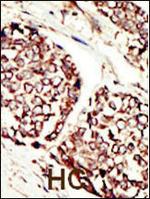 ErbB3 Antibody in Immunohistochemistry (Paraffin) (IHC (P))