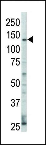 ErbB4 Antibody in Western Blot (WB)