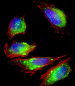 FGFR2 Antibody in Immunocytochemistry (ICC/IF)