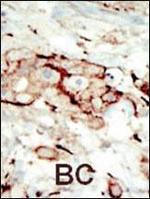 FGFR2 Antibody in Immunohistochemistry (Paraffin) (IHC (P))