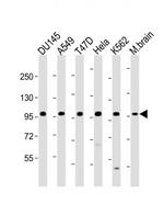 FGFR2 Antibody in Western Blot (WB)