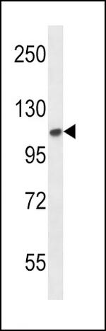 FGFR2 Antibody in Western Blot (WB)