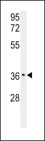 IGFBP3 Antibody in Western Blot (WB)