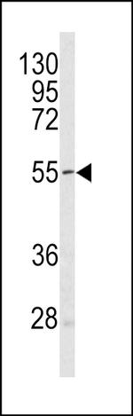 SESN1 Antibody in Western Blot (WB)