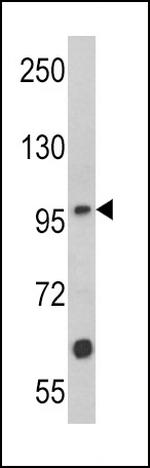 MUSK Antibody in Western Blot (WB)