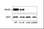 MUSK Antibody in Western Blot (WB)