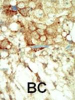 RET Antibody in Immunohistochemistry (Paraffin) (IHC (P))