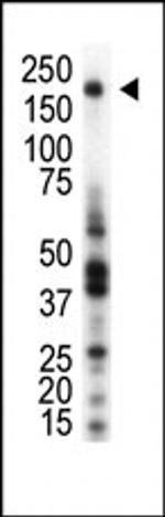 RON Antibody in Western Blot (WB)