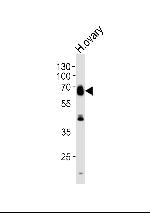 RYK Antibody in Western Blot (WB)