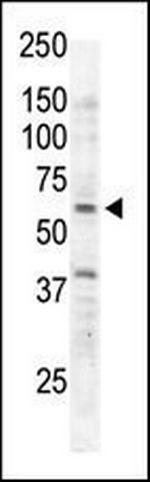 RYK Antibody in Western Blot (WB)