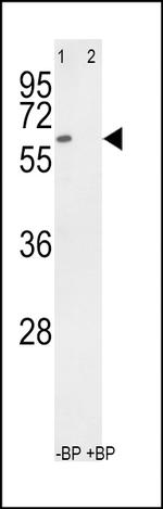 RYK Antibody in Western Blot (WB)