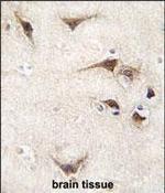 TYRO3 Antibody in Immunohistochemistry (Paraffin) (IHC (P))