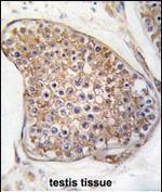 TEK Antibody in Immunohistochemistry (Paraffin) (IHC (P))