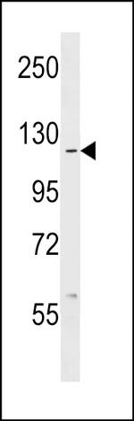 c-Abl Antibody in Western Blot (WB)