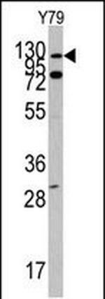 c-Abl Antibody in Western Blot (WB)