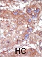 ACK1 Antibody in Immunohistochemistry (Paraffin) (IHC (P))