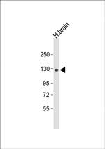 ACK1 Antibody in Western Blot (WB)