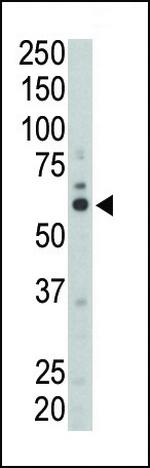 Fyn Antibody in Western Blot (WB)