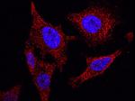 NANOS1 Antibody in Immunocytochemistry (ICC/IF)