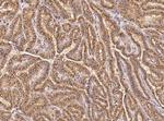 GM130 Antibody in Immunohistochemistry (Paraffin) (IHC (P))