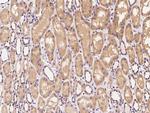 Clathrin Heavy Chain Antibody in Immunohistochemistry (Paraffin) (IHC (P))