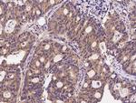 Clathrin Heavy Chain Antibody in Immunohistochemistry (Paraffin) (IHC (P))