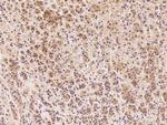 Clathrin Heavy Chain Antibody in Immunohistochemistry (Paraffin) (IHC (P))