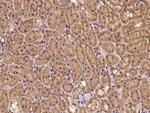 Clathrin Heavy Chain Antibody in Immunohistochemistry (Paraffin) (IHC (P))