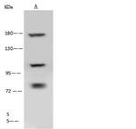 Clathrin Heavy Chain Antibody in Western Blot (WB)