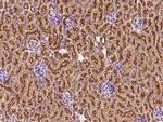 Clathrin Heavy Chain Antibody in Immunohistochemistry (Paraffin) (IHC (P))