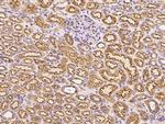 Clathrin Heavy Chain Antibody in Immunohistochemistry (Paraffin) (IHC (P))