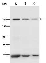 Clathrin Heavy Chain Antibody in Western Blot (WB)