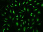 Fe65 Antibody in Immunocytochemistry (ICC/IF)