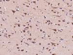 PSMC2 Antibody in Immunohistochemistry (Paraffin) (IHC (P))