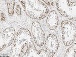 ZO-2 Antibody in Immunohistochemistry (Paraffin) (IHC (P))