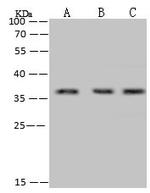 RPRD1B Antibody in Western Blot (WB)