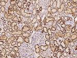 NDRG1 Antibody in Immunohistochemistry (Paraffin) (IHC (P))