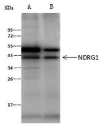 NDRG1 Antibody in Immunoprecipitation (IP)