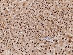 SCLY Antibody in Immunohistochemistry (Paraffin) (IHC (P))