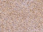 SCLY Antibody in Immunohistochemistry (Paraffin) (IHC (P))