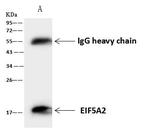 eIF5A2 Antibody in Immunoprecipitation (IP)