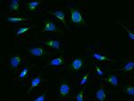 ARF3 Antibody in Immunocytochemistry (ICC/IF)