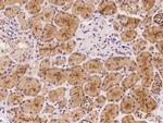 PAR6 Antibody in Immunohistochemistry (Paraffin) (IHC (P))