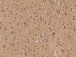 ATP6V1F Antibody in Immunohistochemistry (Paraffin) (IHC (P))