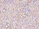 CTR2 Antibody in Immunohistochemistry (Paraffin) (IHC (P))