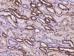 CRP2 Antibody in Immunohistochemistry (Paraffin) (IHC (P))